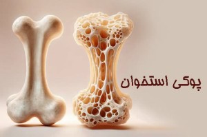 تقاطع سلامت استخوان با مزاج، تغذیه و عملکرد معده